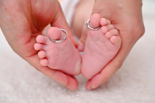 扶余孕妇怎样预防妊娠纹